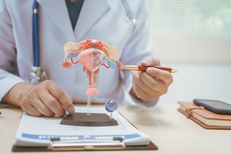 Ovarian Cancer------35